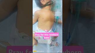 DIAGNOSIS CHDASD baby7 cute baby turtule newbornstyle chd asd viralvideo reels trending [upl. by Ahsiekit]