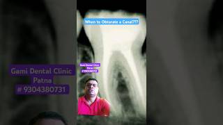 When to Obturate a Canal  RCT Obturation Canal Sealing Root Canal Obturation [upl. by Nnylamme]