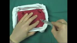 Fine needle aspiration tutorial [upl. by Enar]