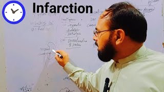 infarction  infarction pathology in urduinfarction general pathology  myocardial infarction❤️‍🔥 [upl. by Levy]