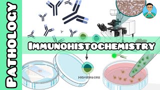 Immunohistochemistry  Pathology  USMLE NCLEX [upl. by Nealy459]