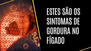 Cuidado Estes são os sintomas de gordura no fígado [upl. by Jehu887]