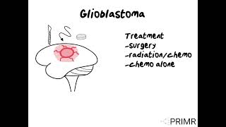 Glioblastoma and How It Is Treated [upl. by Harpp558]