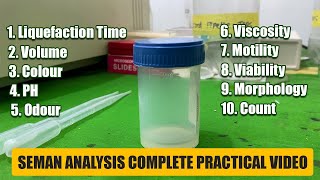 Semen Analysis Test Lab  Complete Practical Video  Medilablife [upl. by Topliffe490]