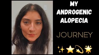 Let’s Talk  Alopecia Journey  Female Pattern Hairloss [upl. by Rodablas991]