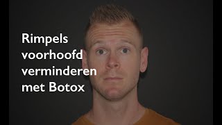 Rimpels voorhoofd voorhoofdrimpels verwijderen met Botox [upl. by Ahtenek851]