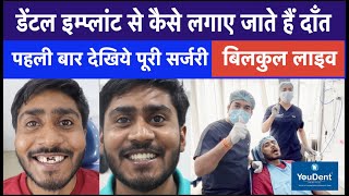 Complete Procedure of Dental implant  Best Teeth Implant Hospital in India  Implant By DR Rajesh [upl. by Myrtia]