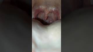 how human mouth looks like inside [upl. by Vergos562]