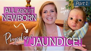 Newborn Jaundice Everything You Need to Know  Sarah Lavonne [upl. by Diogenes]