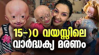 ചെറുപ്പത്തിൽ ബാധിക്കുന്ന അകാല വാർദ്ധക്യം ചികിത്സയില്ലാത്ത അപൂർവ രോഗം Adalia Rose Williams [upl. by Hehre792]