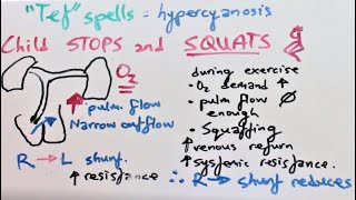 Tetralogy of Fallot Presentation Pathophysiology Diagnosis amp Treatment [upl. by Saxet]