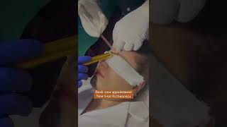 Skin Boosters Treatment  La Midas Aesthetics [upl. by Sivle]