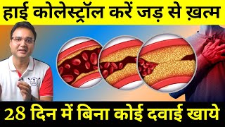 6 Ways To Lower Cholesterol amp Clean Arteries Naturally Without Any Medicine  Healthy Hamesha [upl. by Burg186]