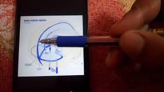 DURAL VENOUS SINUSES simplest explanation part 2 [upl. by Hands623]