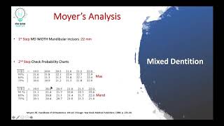 Orthodontic Moyers Analysis Explained in Brief [upl. by Cappello]