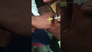 IV Cannula insertion technique shorts​vigo​ लगाना सीखेmedicalstudent​prectice​ timetrending​vi [upl. by Sylvan]