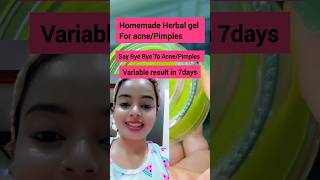 Herbal Anti Pimple Gel  Remove AcnePimples in 7days result 😱shortsfeed shorts shortsvideo acne [upl. by Muire]