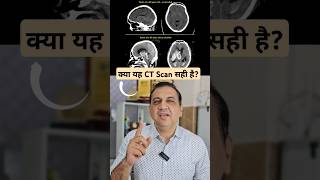 क्या यह CT Scan सही है जानिए न्यूरोसर्जन से NeuroMedTalks01 neurosurgeon ctscan viralvideo [upl. by Laryssa]