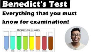 BENEDICTS TEST  The ultimate guide for biochemistry practical viva examination [upl. by Elyk]