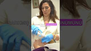 YENİDEN SIKILAŞIN ULTHERAPY İLE CİLT GENÇLEŞTİRME shorts [upl. by Joash]