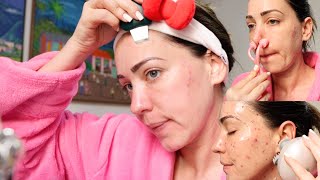 LIMPIEZA FACIAL CASERA con MASAJES RELAJANTES 💆 ASMR para dormir [upl. by Adnarom]