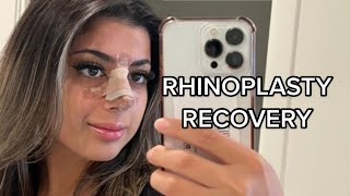 Rhinoplasty Recovery QampA [upl. by Elyag]