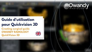 6 Creating surgical guideOWANDY RADIOLOGYQuickVision 3D [upl. by Desdamonna]