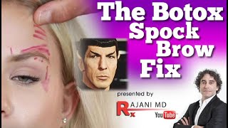 The Spock Brow and Botox Brow Droop Fix Portland Oregon Style Aesthetics with Dr Rajani [upl. by Aluino]