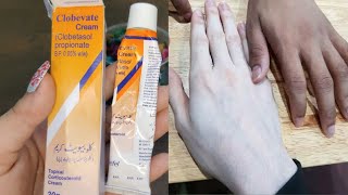 Clobevate cream for whiteninghand and foot whitening cream clobevate cream [upl. by Godber316]