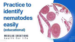 Nematodes Quiz part 1 [upl. by Uahc]