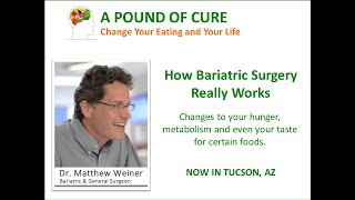 How Bariatric Surgery Really Works  changes your hunger metabolism and even your taste buds [upl. by Pimbley]