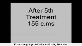 10 cms Height growth with Nadipathy Treatment [upl. by Nnylyoj]