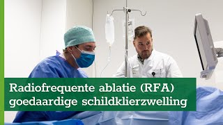 Radiofrequente ablatie RFA bij goedaardige schildklierzwelling [upl. by Annora]