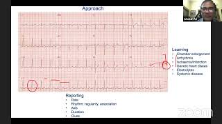 ECG 52 [upl. by Eded]