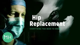 Hip Replacement  Everything you need to know [upl. by Raseta]