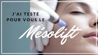 MESOLIFT VISAGE  jai testé [upl. by Irolav]