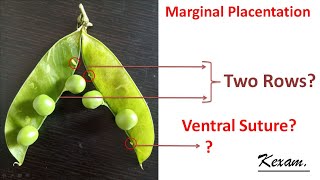 Marginal Placentation Explained NBD5 kexam NEET [upl. by Karyl469]