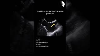 Echocardiography board practice question 17 [upl. by Aiciram]