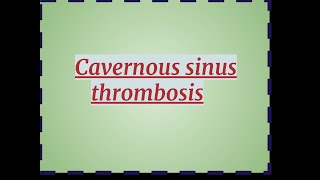 Cavernous sinus Thrombosis [upl. by Eimaraj]