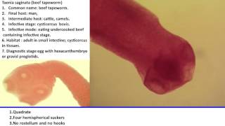 31 Practical Parasitology  Scolex of Taenia Saginata [upl. by Laddy]