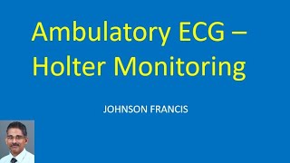 Ambulatory ECG – Holter Monitoring [upl. by Ahsekal]