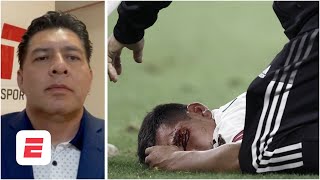 LA LESIÓN DEL CHUCKY LOZANO EN FOTOS El Doctor Meraz analiza el duro golpe a Hirving  Copa Oro [upl. by Ailedamla]