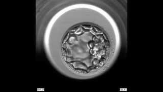 EmbryoScope Embryo Development  Blastocyst [upl. by Mario]