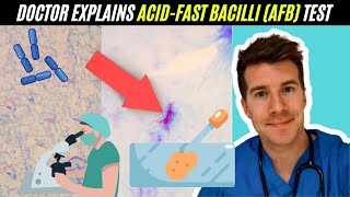 Doctor explains AcidFast Bacilli AFB test  Mycobacterium Tuberculosis TB [upl. by Aineval]