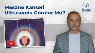 Mesane Kanseri Ultrasonda Görülür Mü  Mesane Kanseri  Prof Dr Abdullah Armağan [upl. by Llemor]