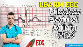 الايقاع الكاذب Learn ECG Pulseless Electrical Activity PEA [upl. by Demakis]