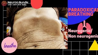 Paradoxical breathing pattern  Diaphragmatic paradox paradoxicalrespiration diaphragmaticpalsy [upl. by Walburga427]