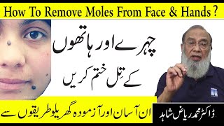 How To Remove Black and Brown Moles Naturally  Chehre Ke Kale Til Khatam Karne Ka asan Tarika [upl. by Neeruam]