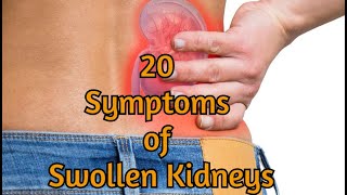 20 Symptoms of Swollen Kidneys [upl. by Dajma]