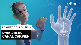 Syndrome du Canal Carpien  Explications – EPITACT [upl. by Byrd503]